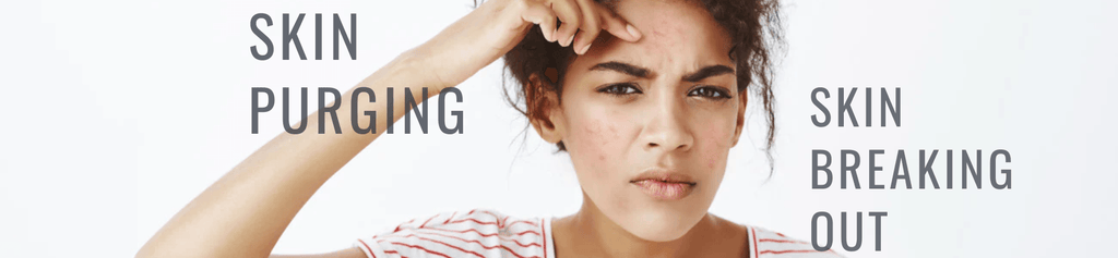 How to Tell if Your Skin Is Purging or Breaking Out?